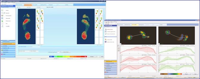 Analisi Posturale Dinamica