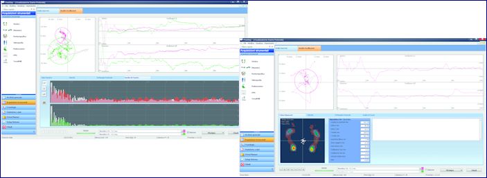 Analisi posturografica